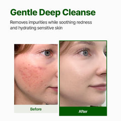 NACIFIC gel cleanser lather illustrates gentle cleansing without leaving residue