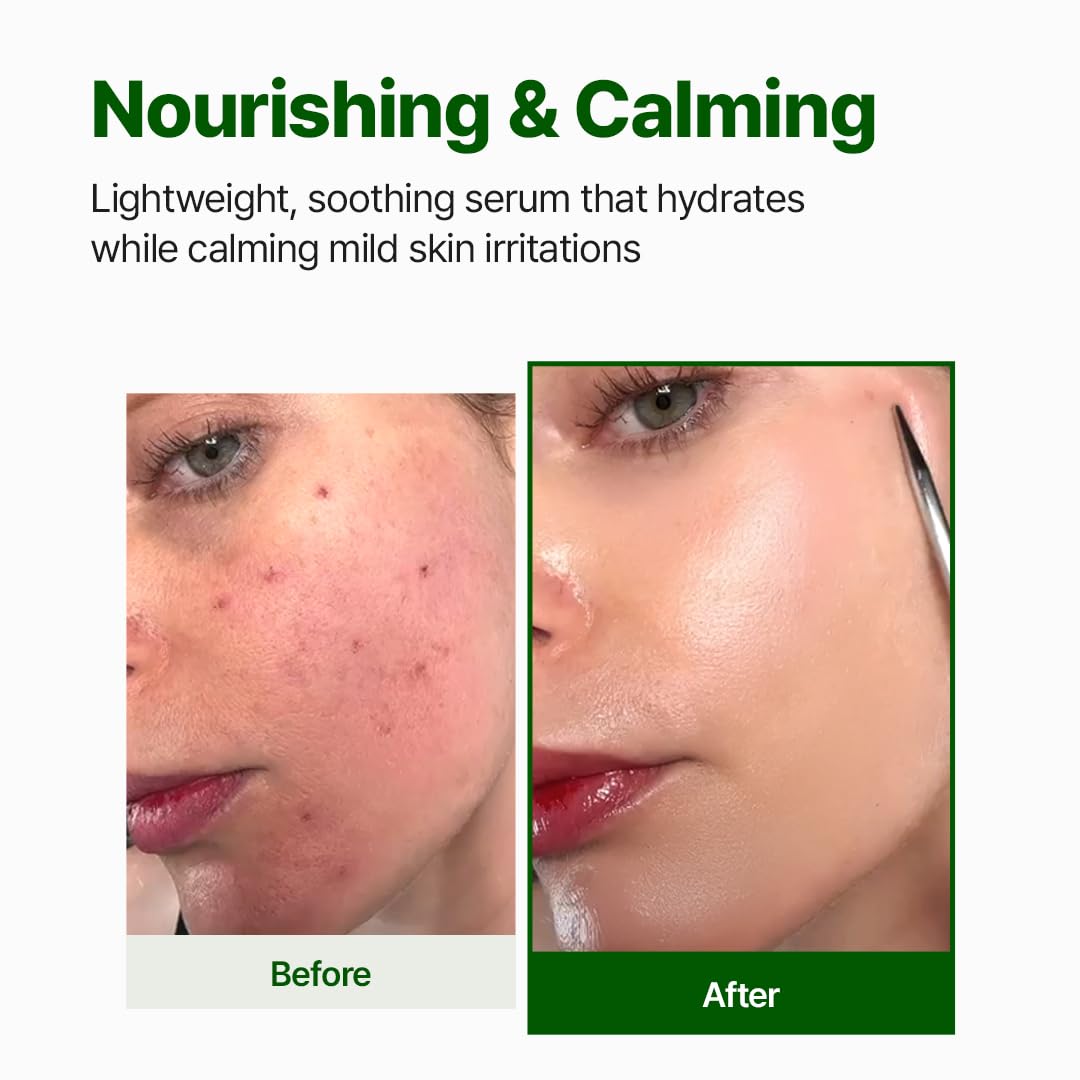 NACIFIC Cica PDRN serum texture drop demonstrating lightweight, quick-absorb feel