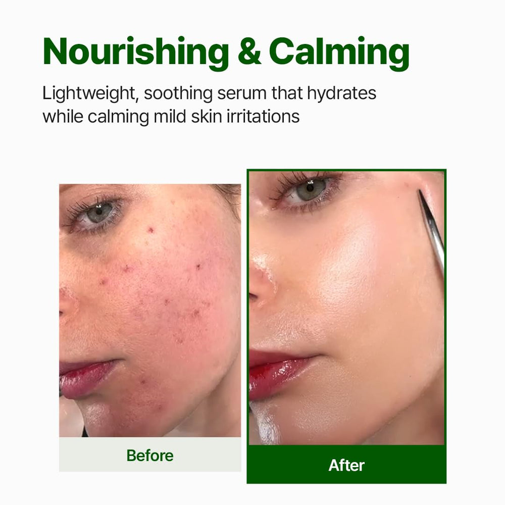 NACIFIC Cica PDRN serum texture drop demonstrating lightweight, quick-absorb feel