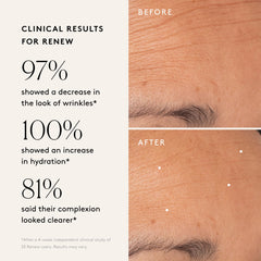 Naked & Thriving Revive Eye Cream on the under-eye area for smoother appearance