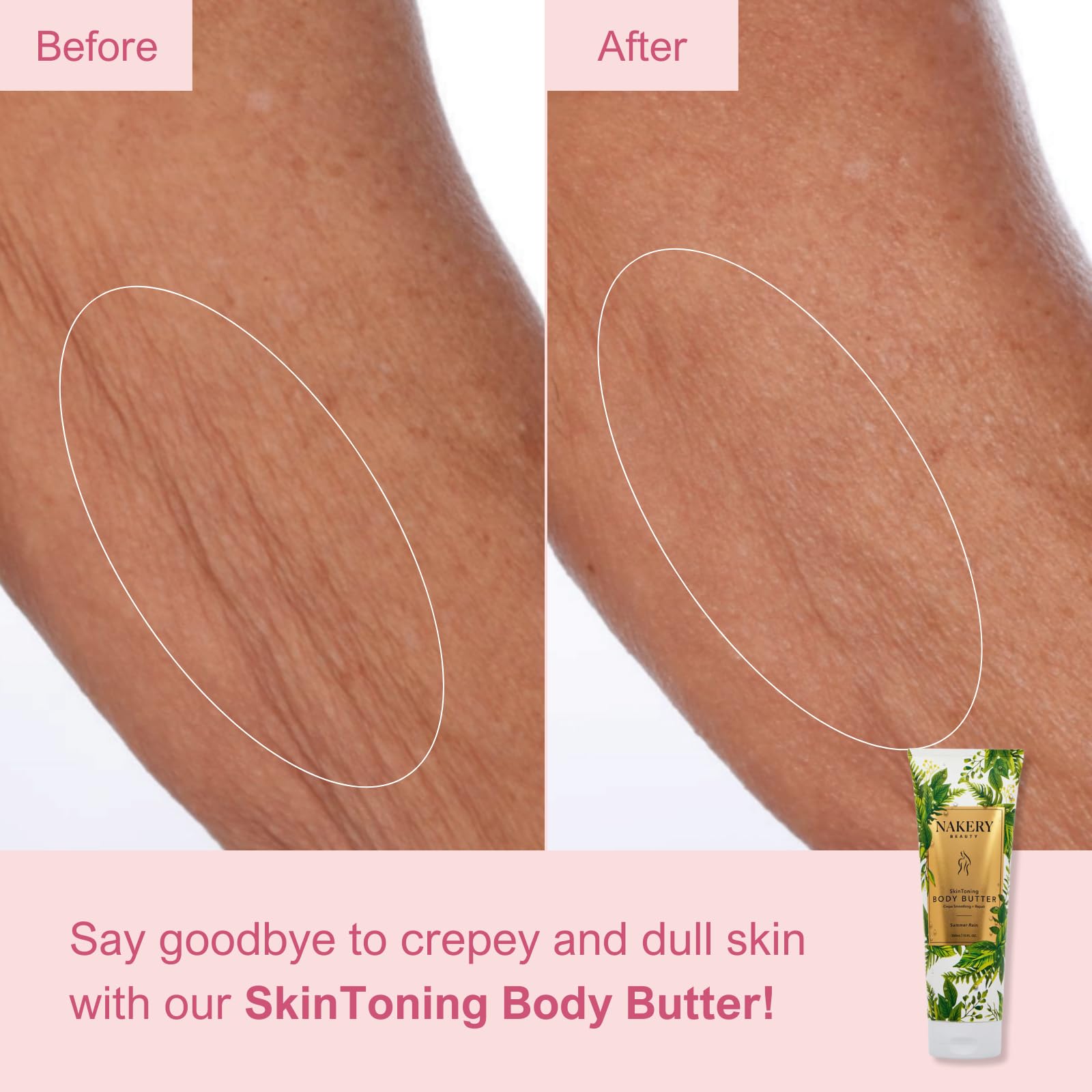 Nakery Crepey Skin Tightening Butter lifts areas prone to crepeiness