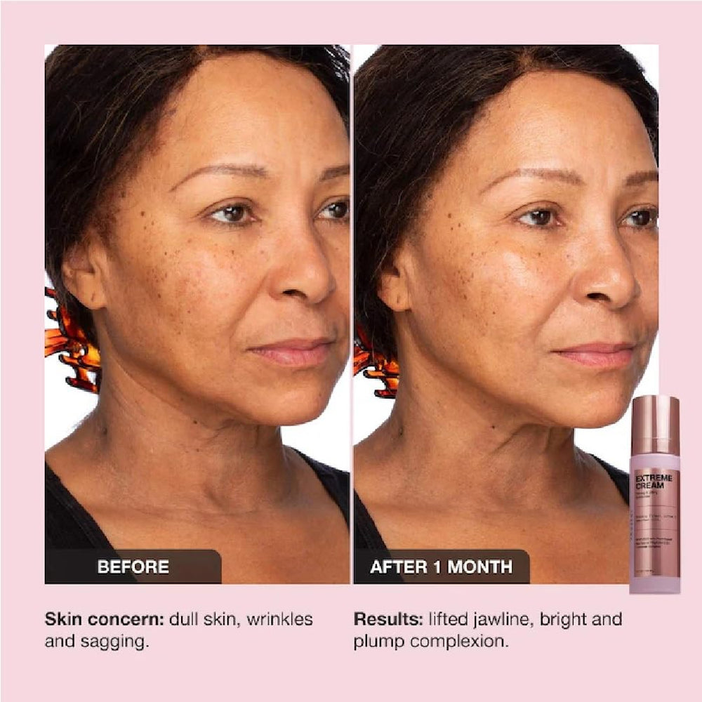 NAPH iNNBEAUTY Extreme Cream jar open with swirl demonstrating rich formula