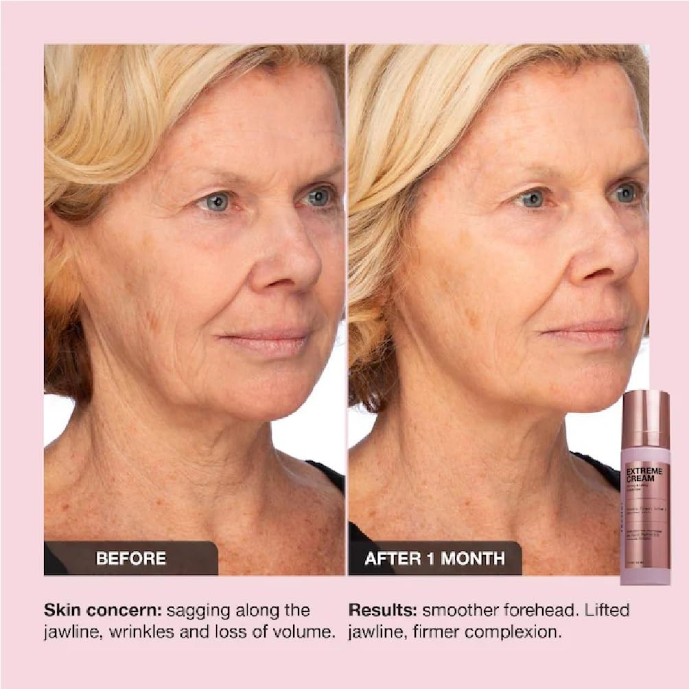 NAPH iNNBEAUTY Extreme Cream refill packaging highlighting sustainability