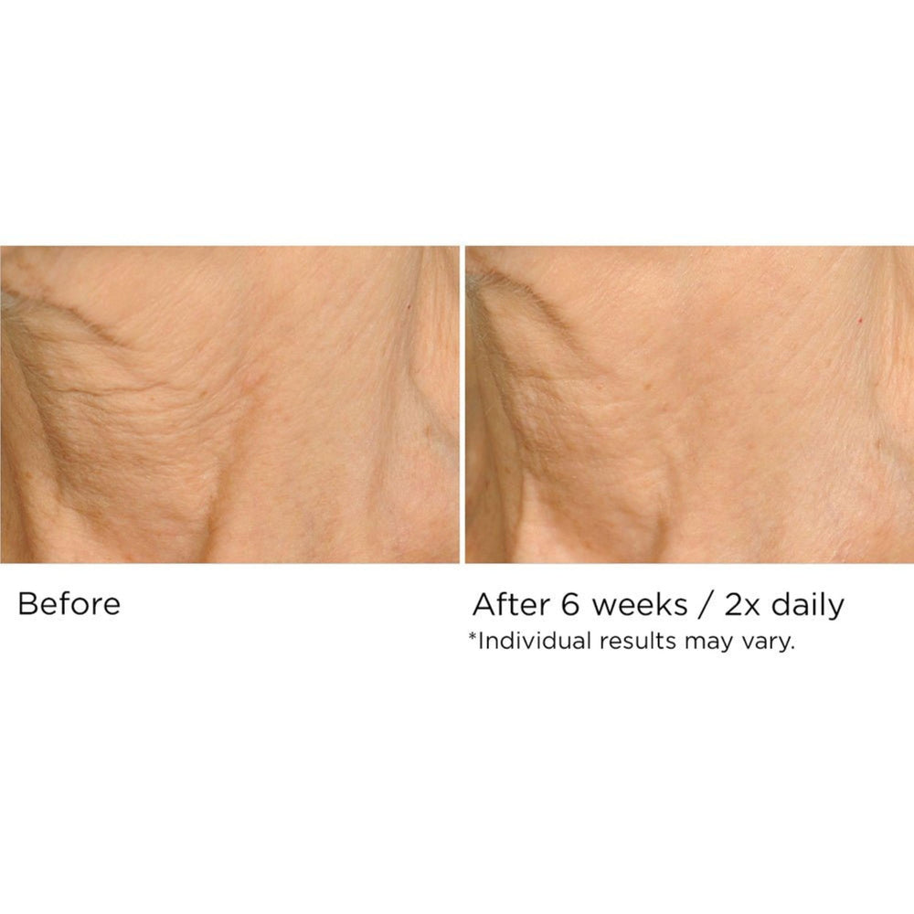 NASSIFMD Deco-Lift neck absorption shot highlights fast-penetrating formula.