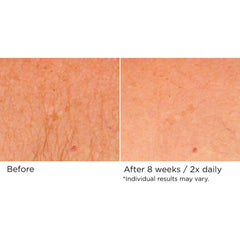 NASSIFMD Deco-Lift neck before-after style image hints at potential firming.