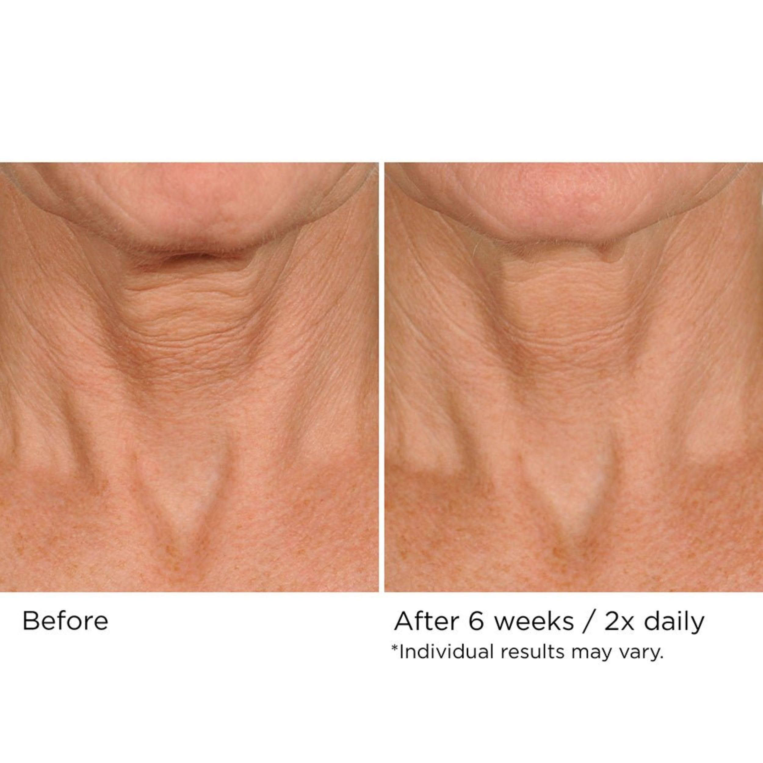 NASSIFMD Deco-Lift neck routine image emphasizes daily self-care.