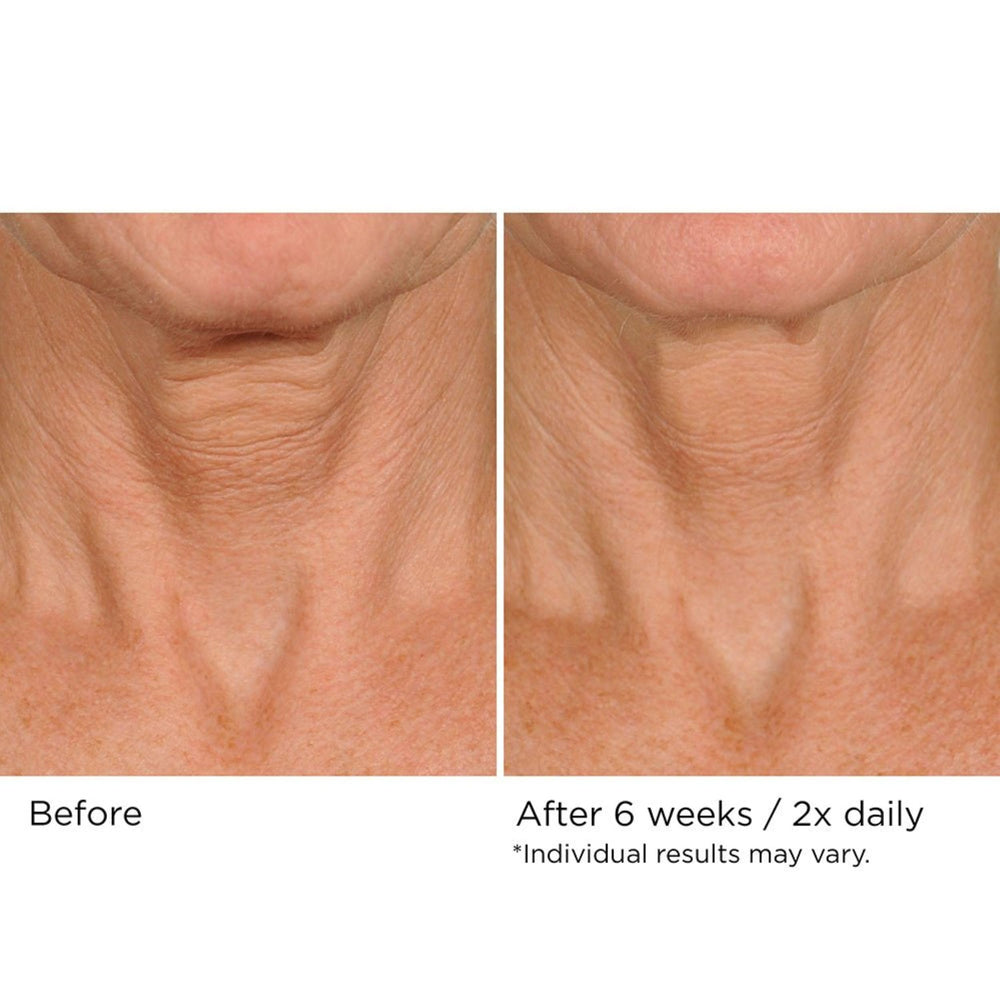 NASSIFMD Deco-Lift neck routine image emphasizes daily self-care.