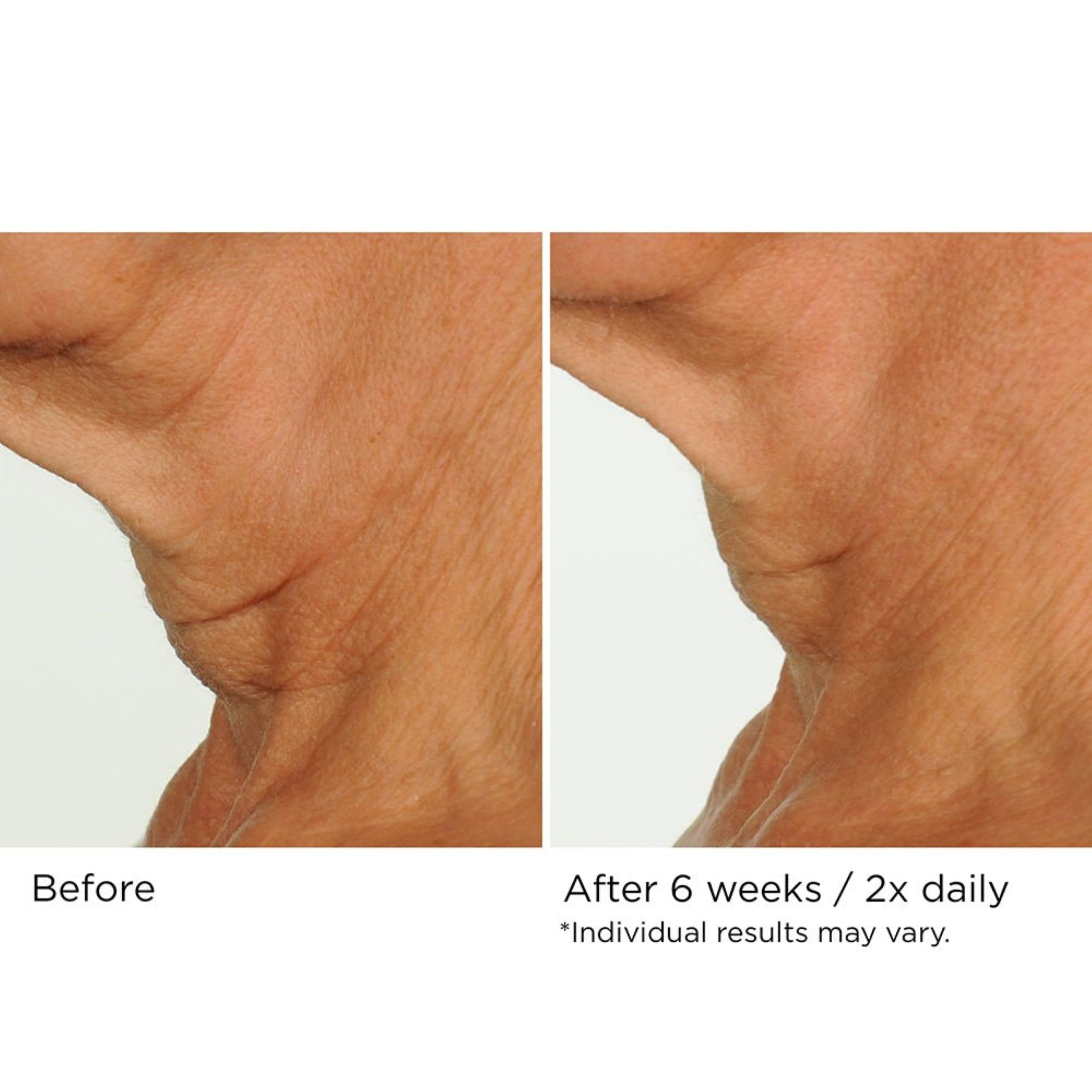 NASSIFMD Deco-Lift neck décolleté application demonstrates smooth, even coverage.