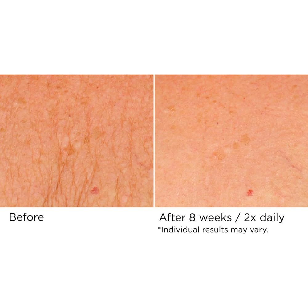 NassifMD Deco-Lift neck and décolletage glow with smooth texture