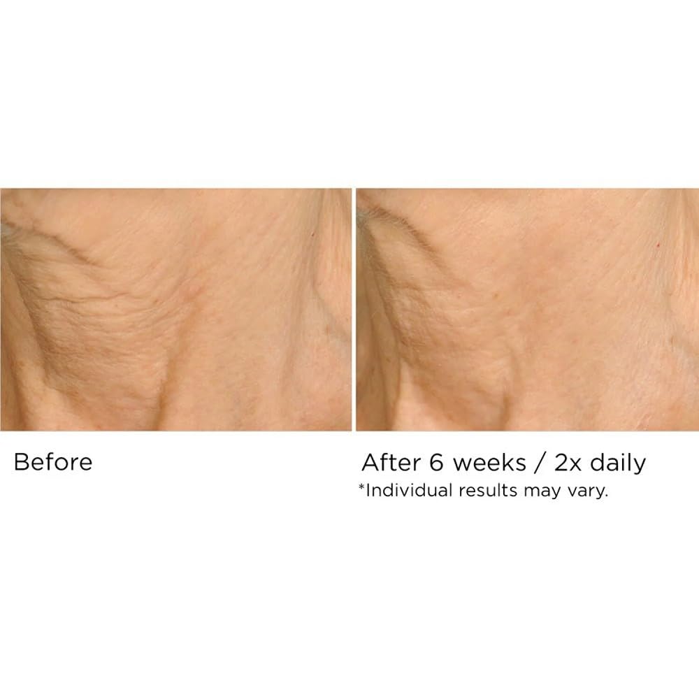 NassifMD Deco-Lift serum tube showing lightweight gel that absorbs quickly