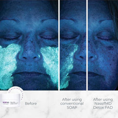 NassifMD Exfoliating Detox Pads close-up of texture with exfoliating particles