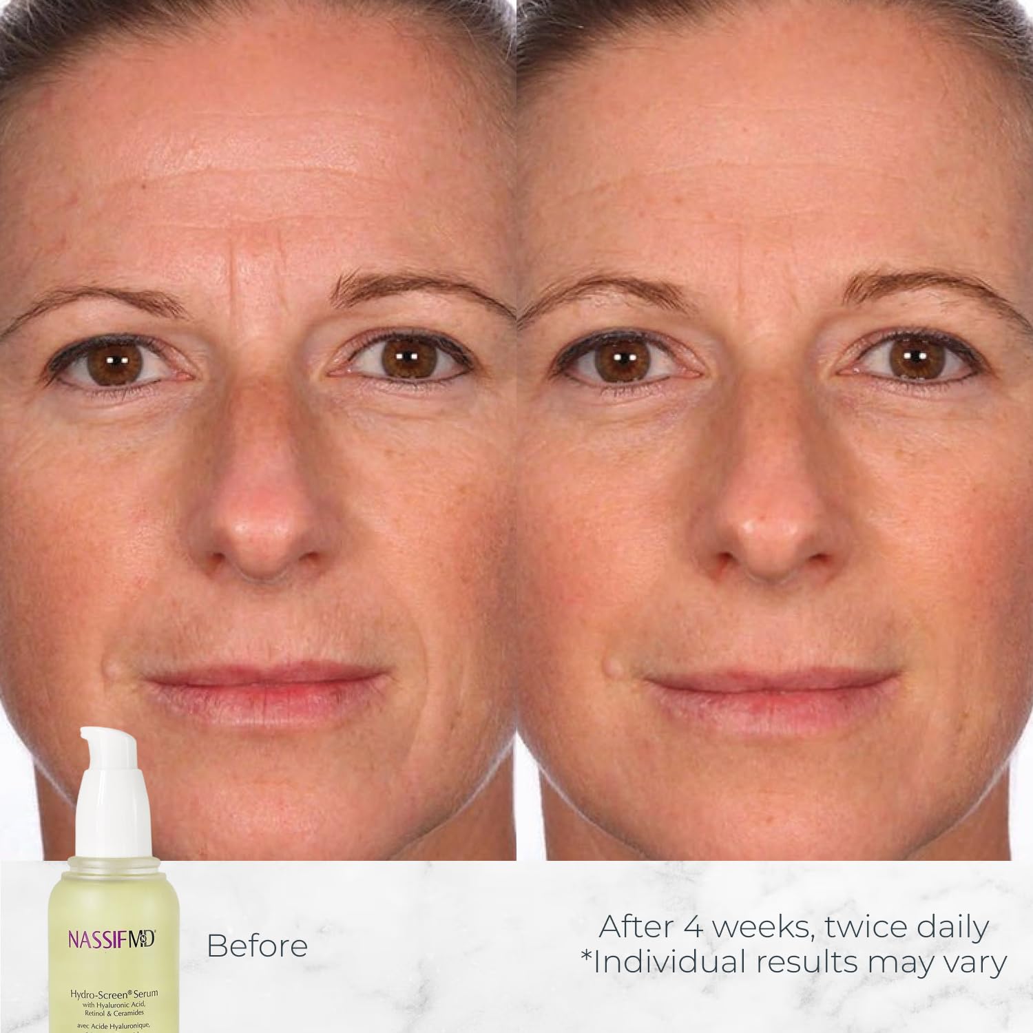 NassifMD Hydro-Screen Serum dispensing pump demonstrating controlled application