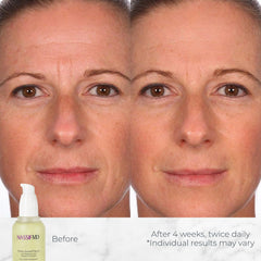 NassifMD Hydro-Screen Serum dispensing pump demonstrating controlled application