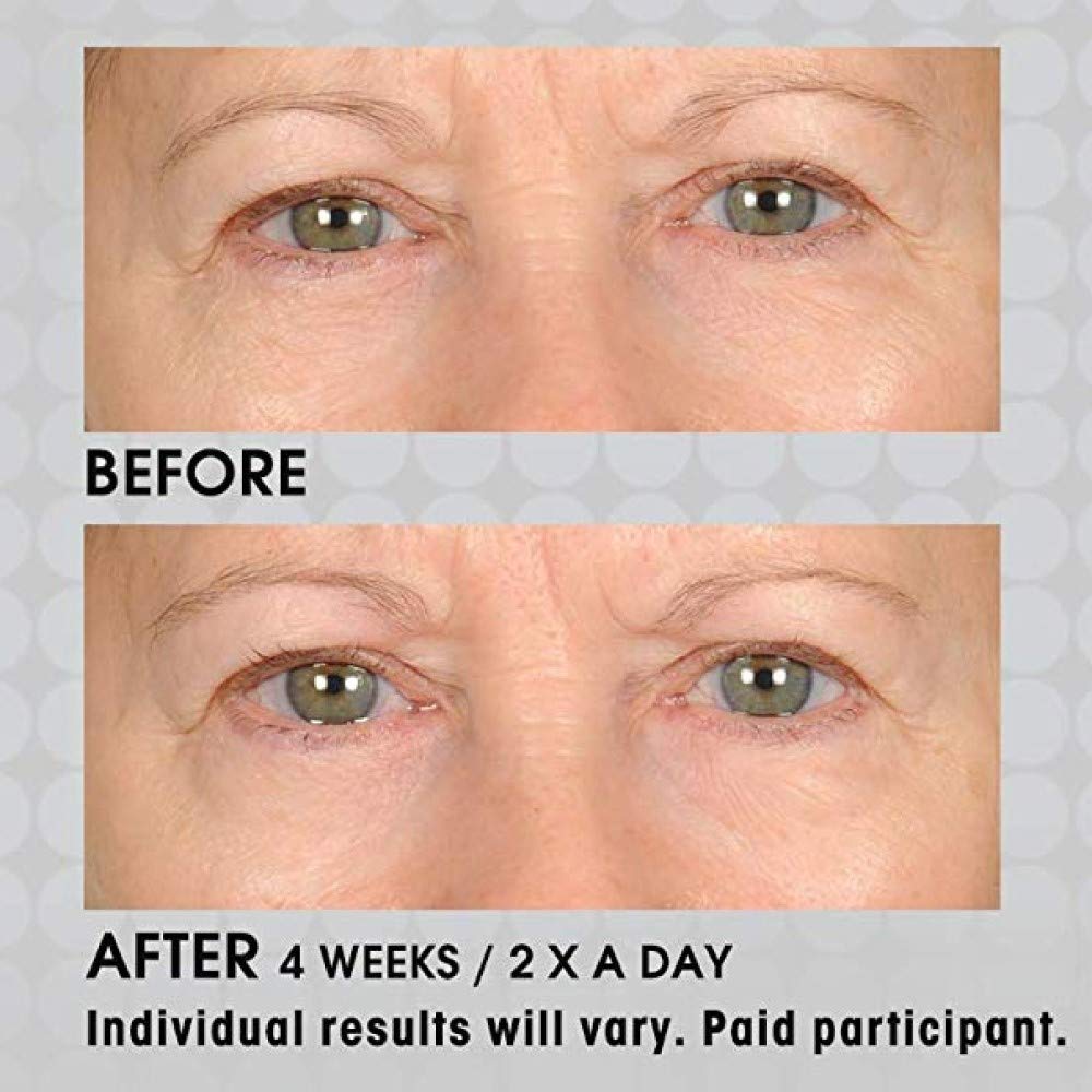 NassifMD non-greasy finish shown on skin after application.