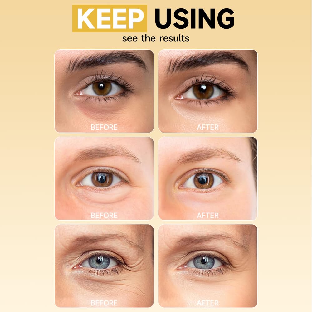 Natener bio-collagen patches support elasticity and hydration.