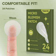 Naterido 24-patch kit ready in purse for quick touch-ups