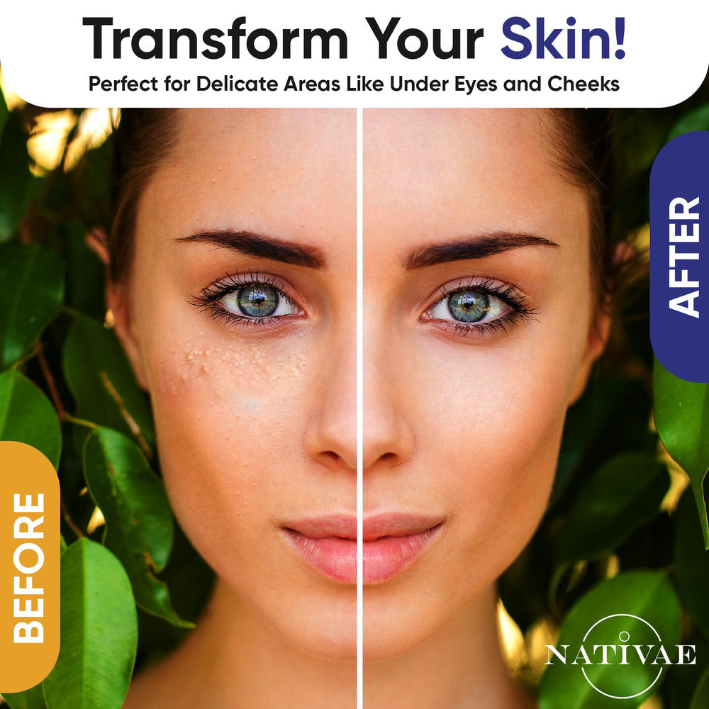 Nativae Milia Remover facial application on cheeks for gentle exfoliation