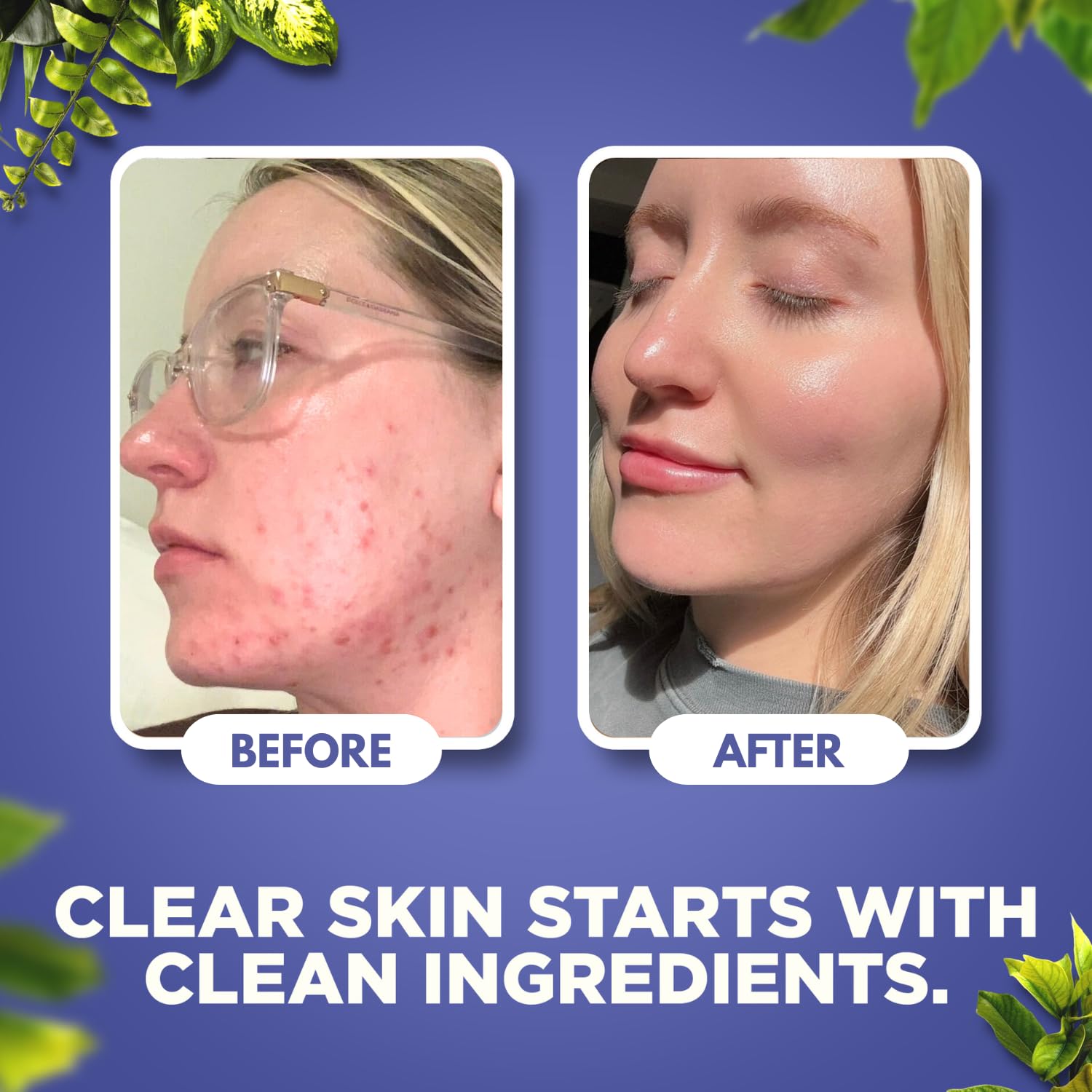 Natural Aura application on skin demonstrates smooth non greasy finish