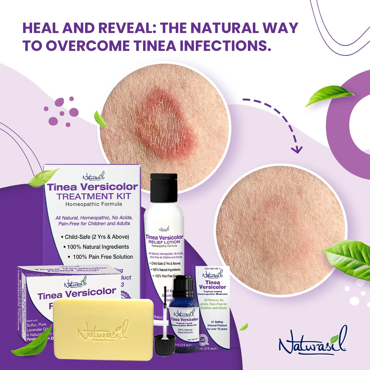 Naturasil hand applying soap on arm for soothing cleansing