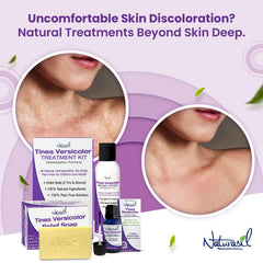 Naturasil Tinea Versicolor Soap bar close-up with lather for cleansing action