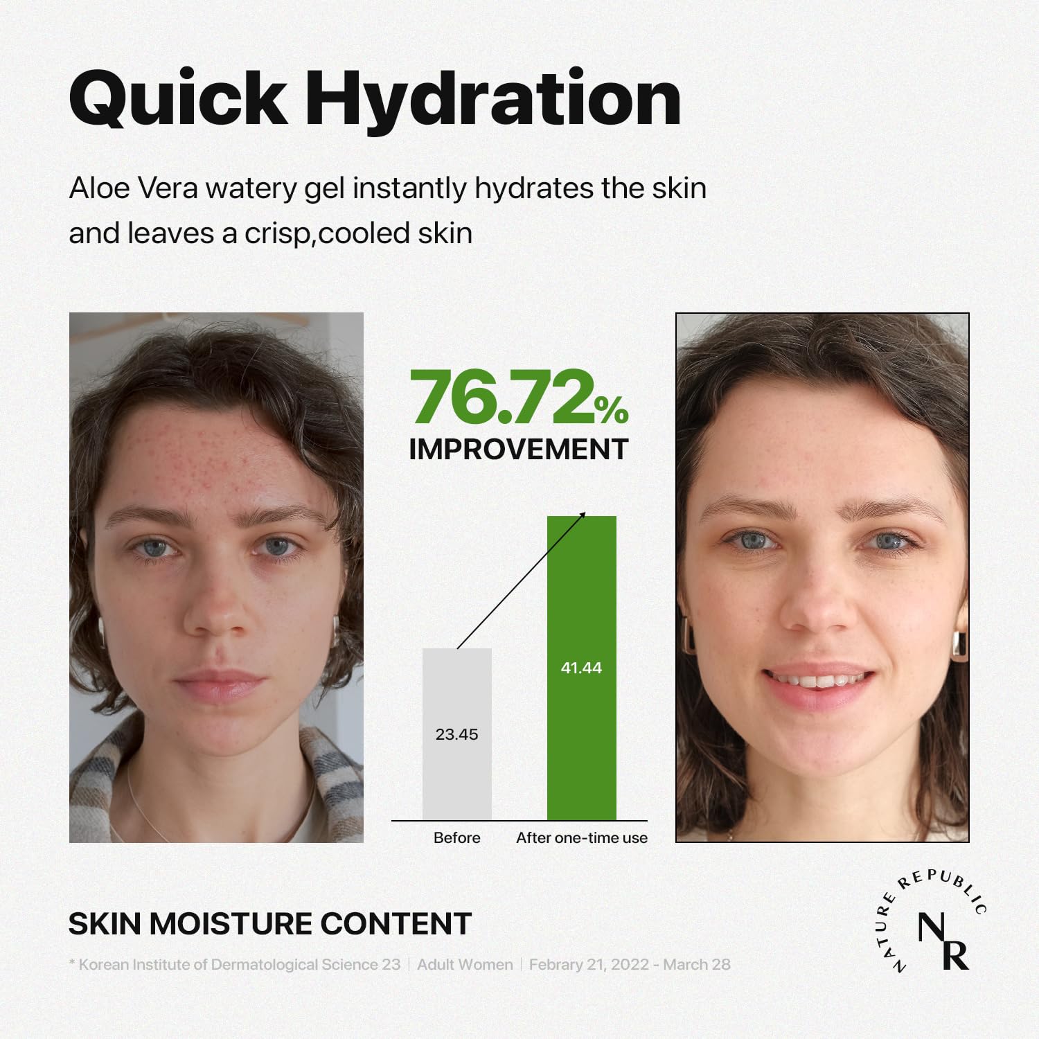 Nature Republic Aloe Vera Watery Gel chilled for a refreshing cool-down after sun exposure.