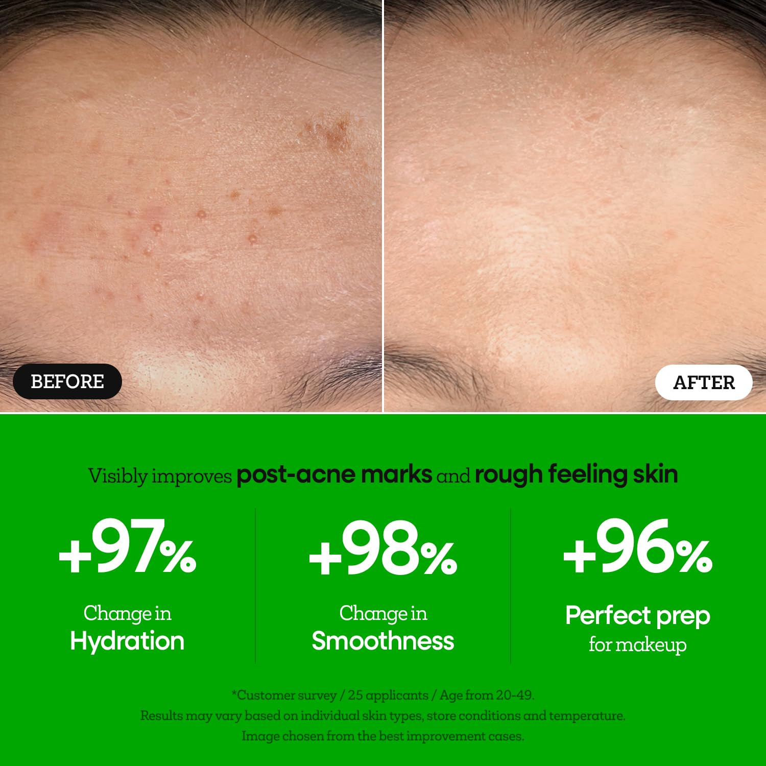 Nature Republic The First Peptide Boosting Serum box packaging highlights premium formulation.