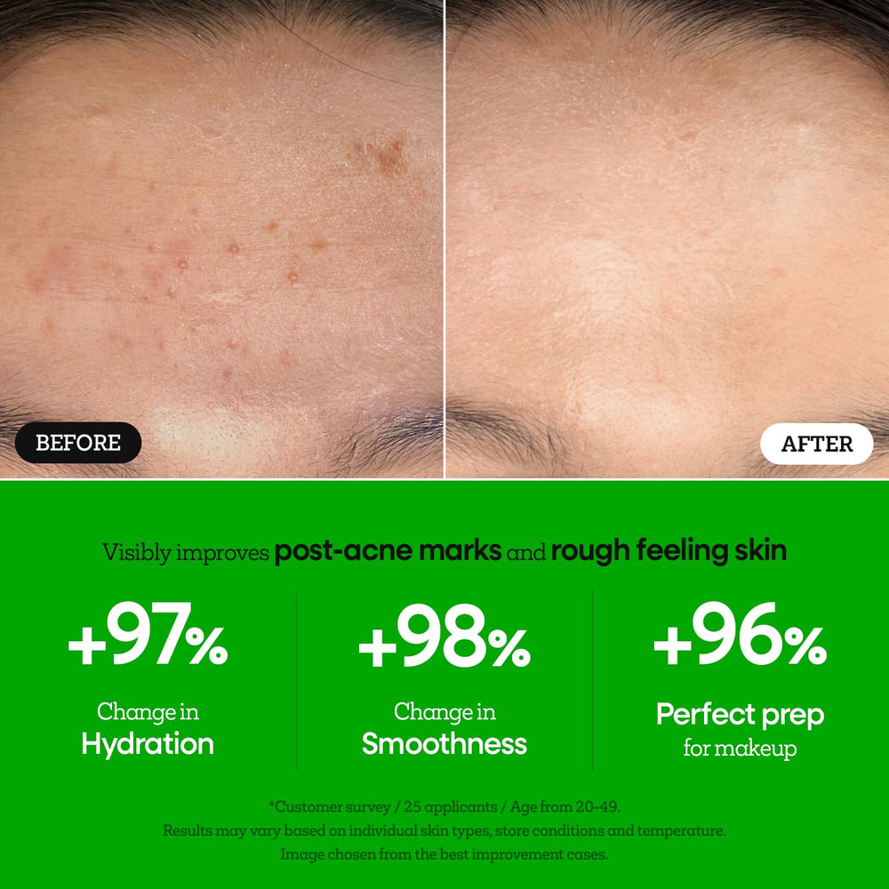 Nature Republic The First Peptide Boosting Serum box packaging highlights premium formulation.