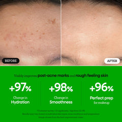 Nature Republic The First Peptide Boosting Serum box packaging highlights premium formulation.