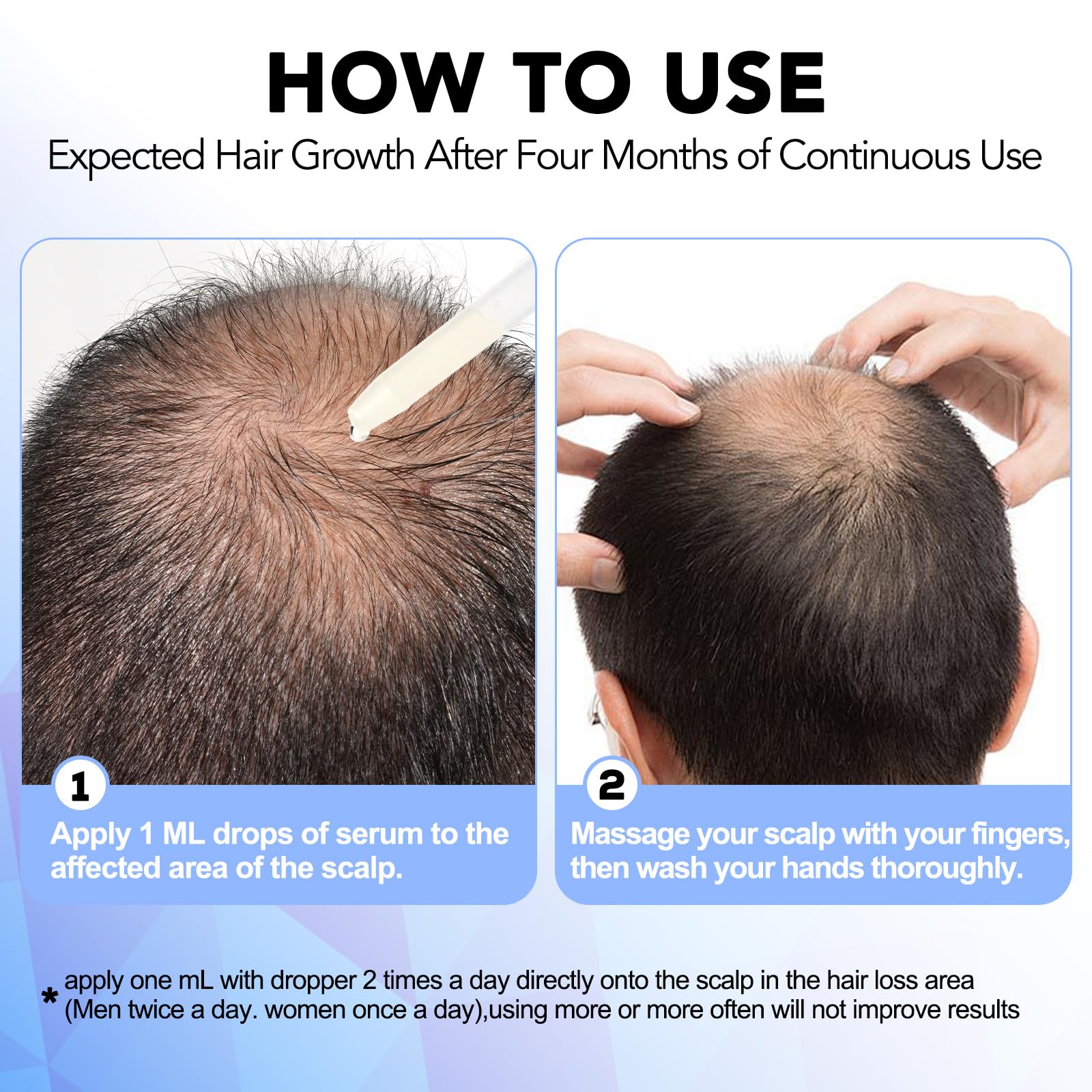 Nature Ziran Minoxidil for women supports thinning hair at home with routine use.