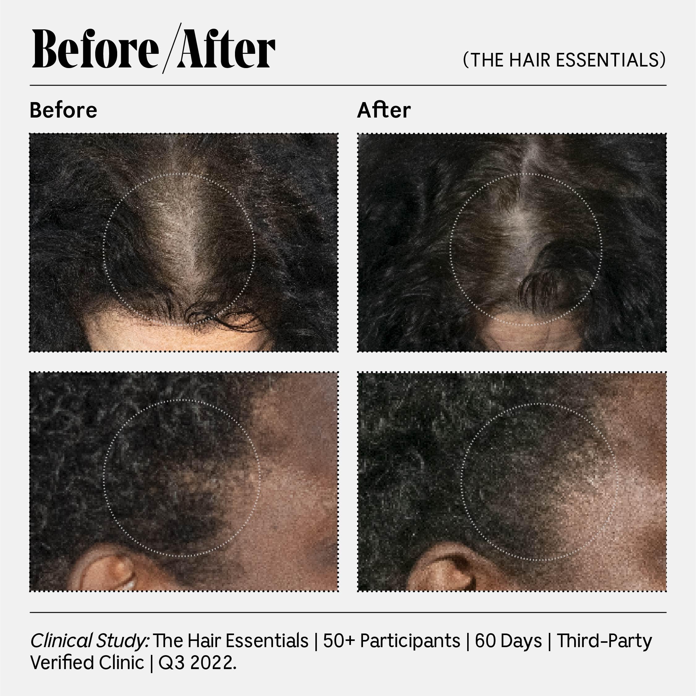 Nécessaire Scalp Serum dermatologist-tested ensures a hypoallergenic, fragrance-free option for sensitive users.