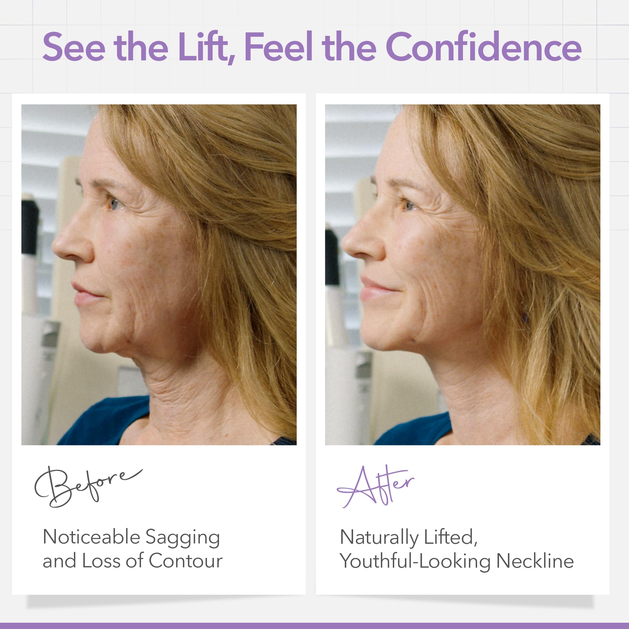 NECK LESS invisible film under makeup showcases natural movement and discreet lift.