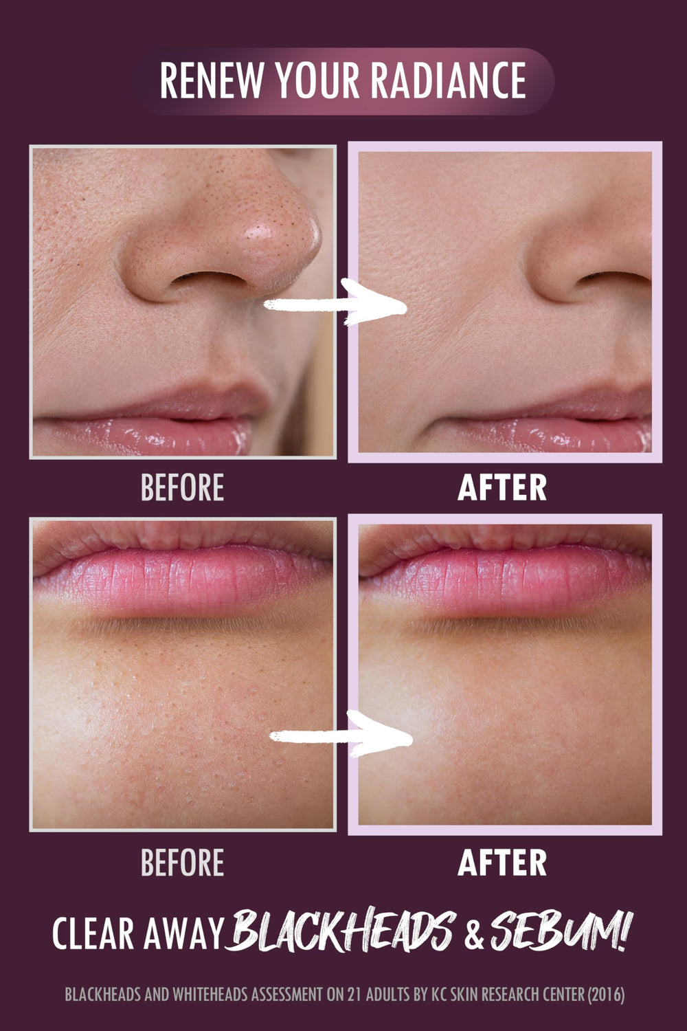 Macro closeup highlights exfoliating particles and a smooth skin surface.