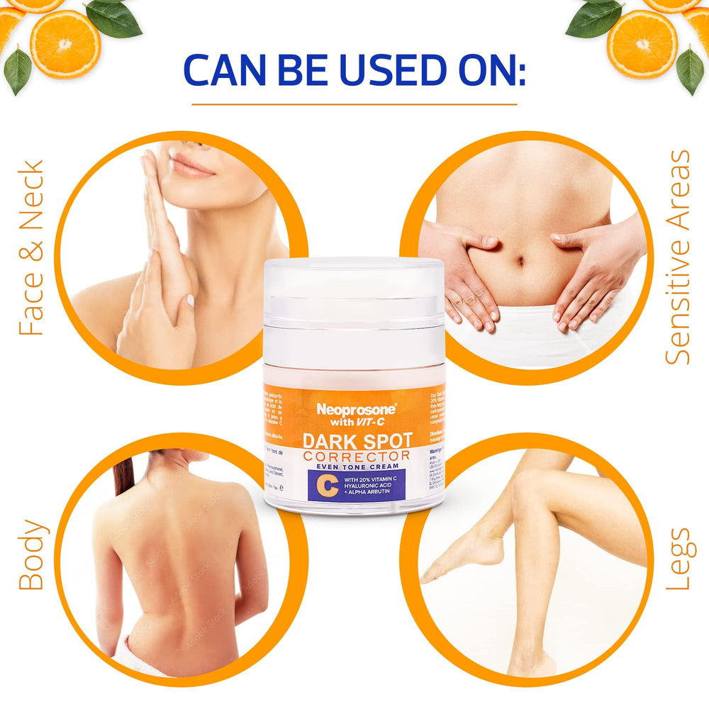 Tube application shows targeted spots on skin with Neoprosone