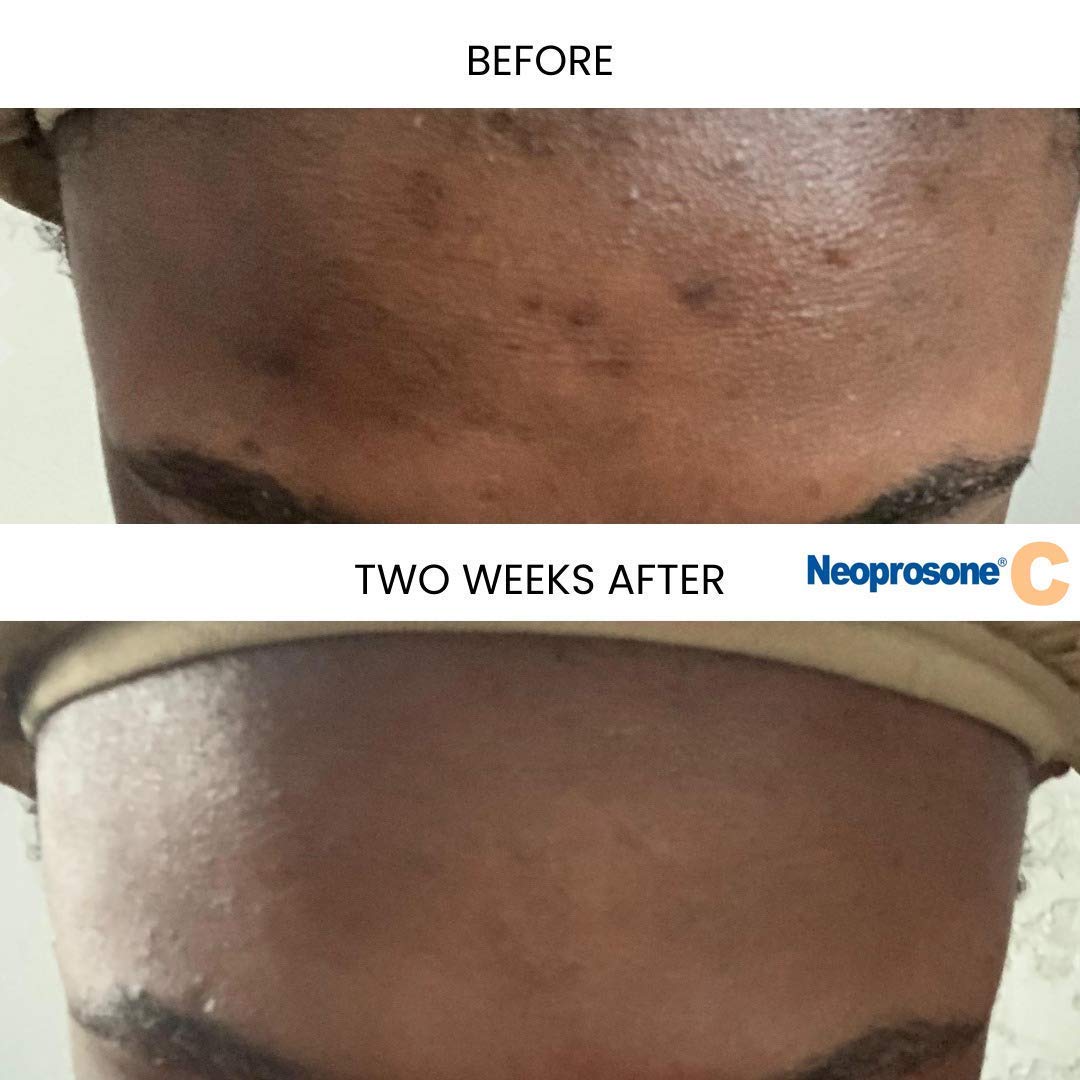 Texture swatch of Neoprosone serum showing light, fast-absorbing finish