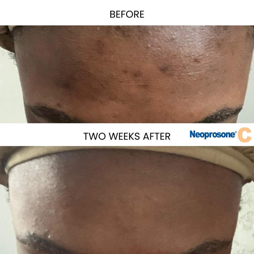 Texture swatch of Neoprosone serum showing light, fast-absorbing finish