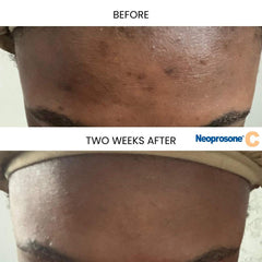 Texture swatch of Neoprosone serum showing light, fast-absorbing finish
