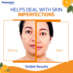 Neoprosone Vit C Dark Spot Corrector ingredients label highlights Vitamin C and Hyaluronic Acid