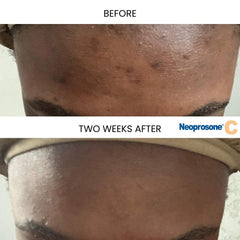Neoprosone Vitamin C Serum close-up shows lightweight texture and quick absorption