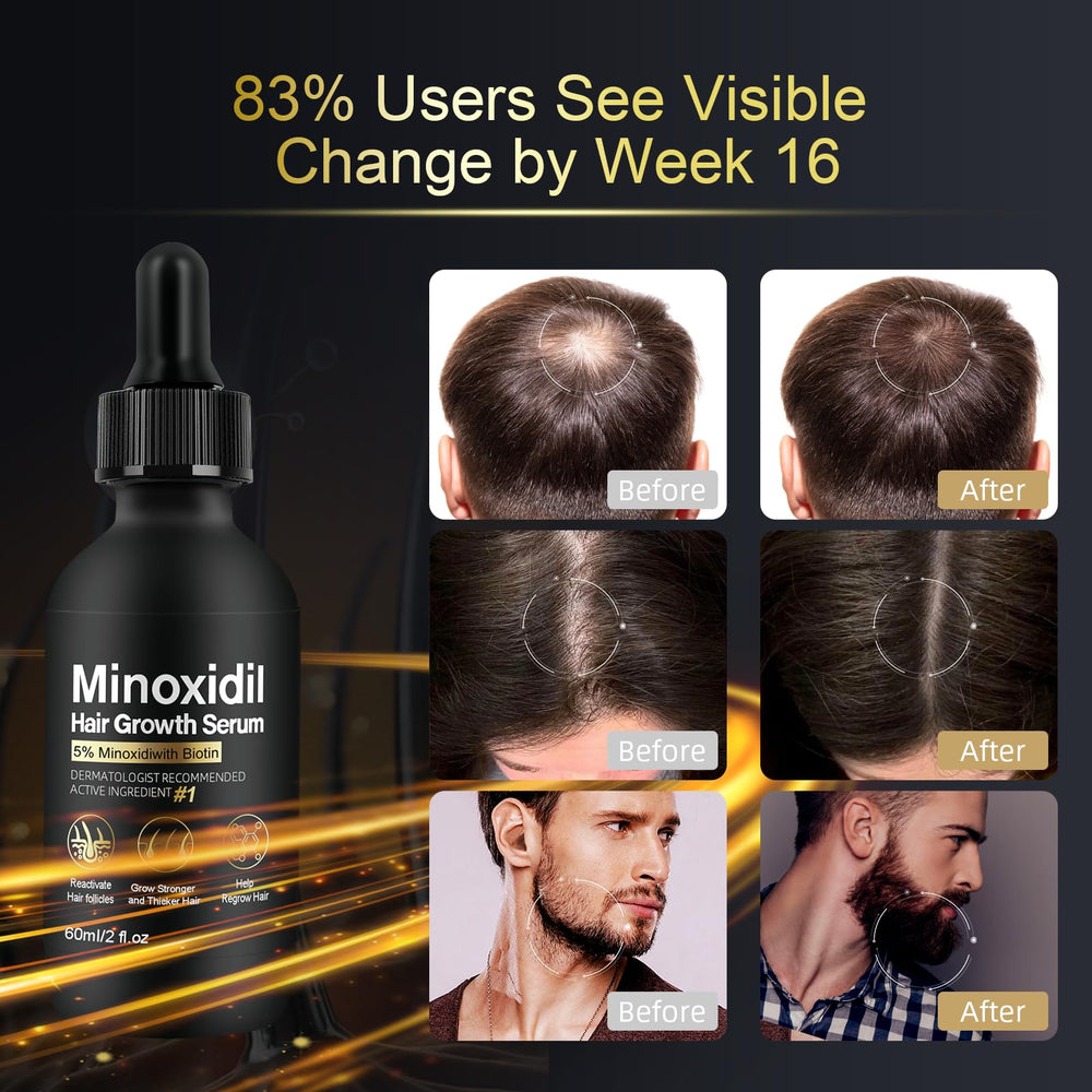 NETYIYUN scalp-spot application targets thinning edges with precision and care.