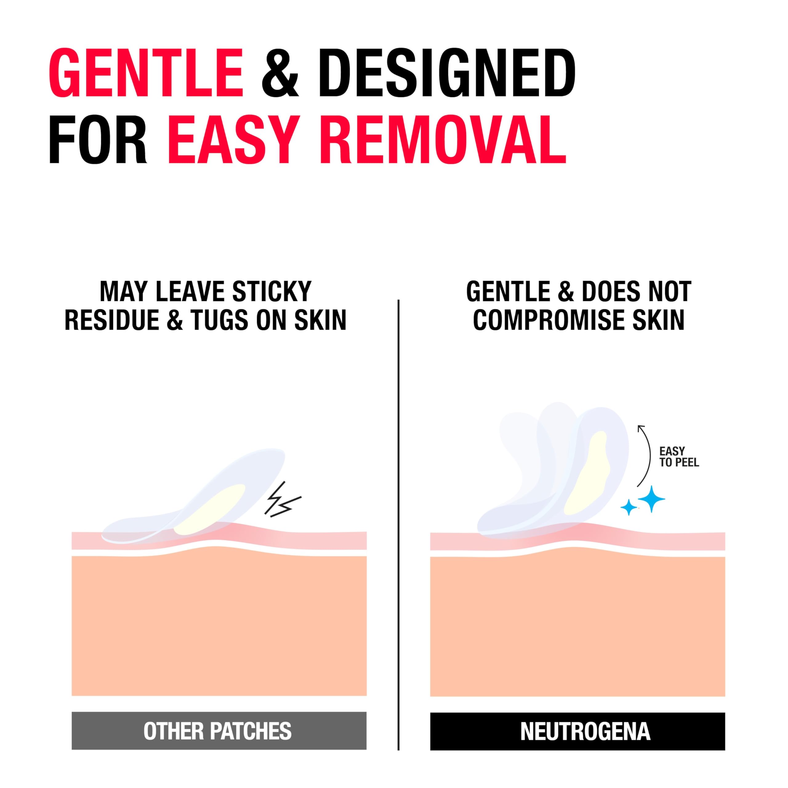 Neutrogena hydrocolloid patches applied on skin protect pimples while absorbing fluid