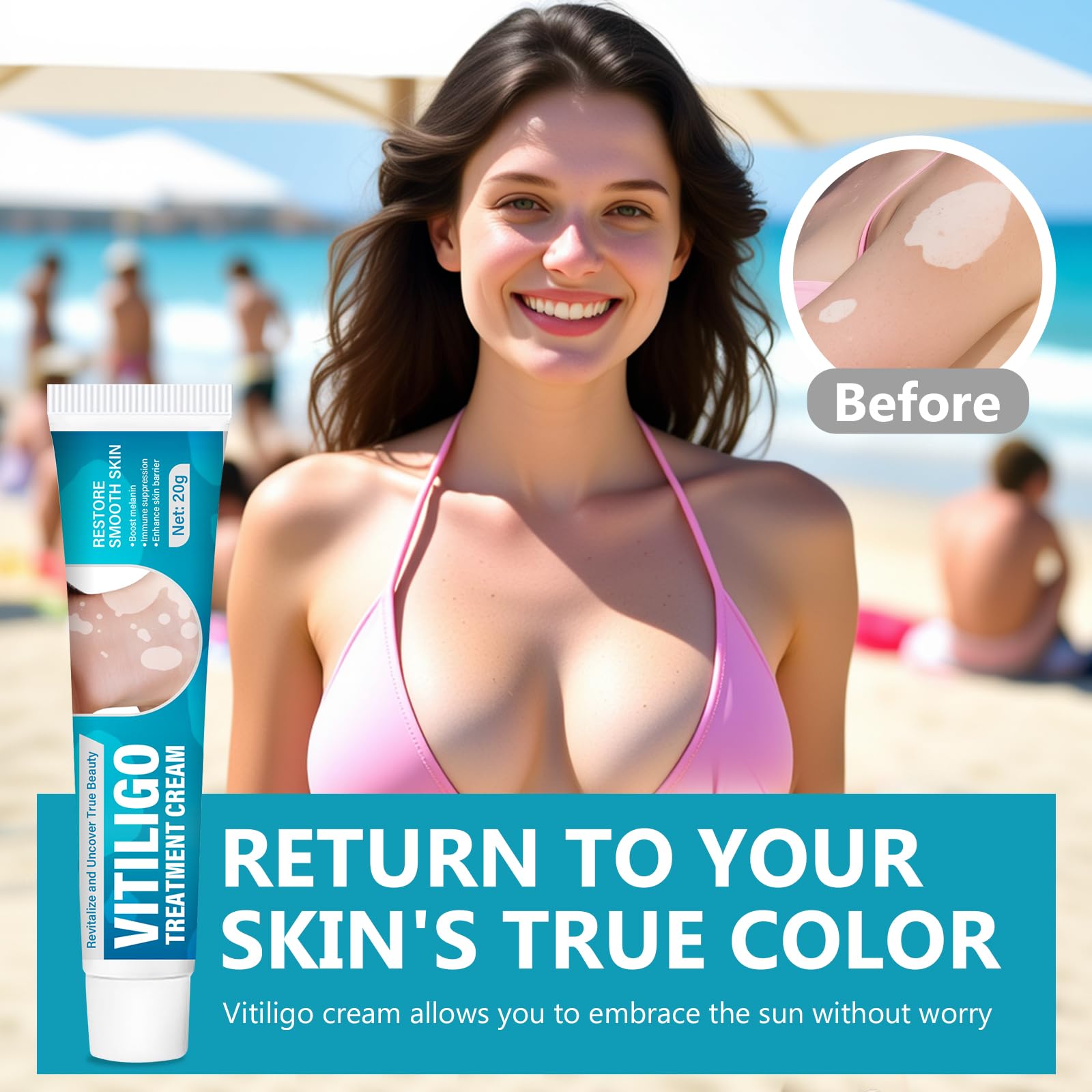 NHZ Vitiligo Cream closeup shows creamy texture for depigmented areas.