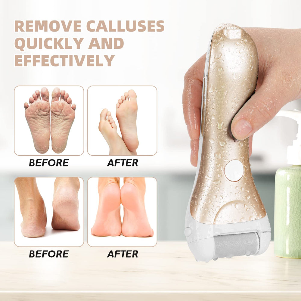 NiceBirdie coarse roller head 2 for faster skin renewal