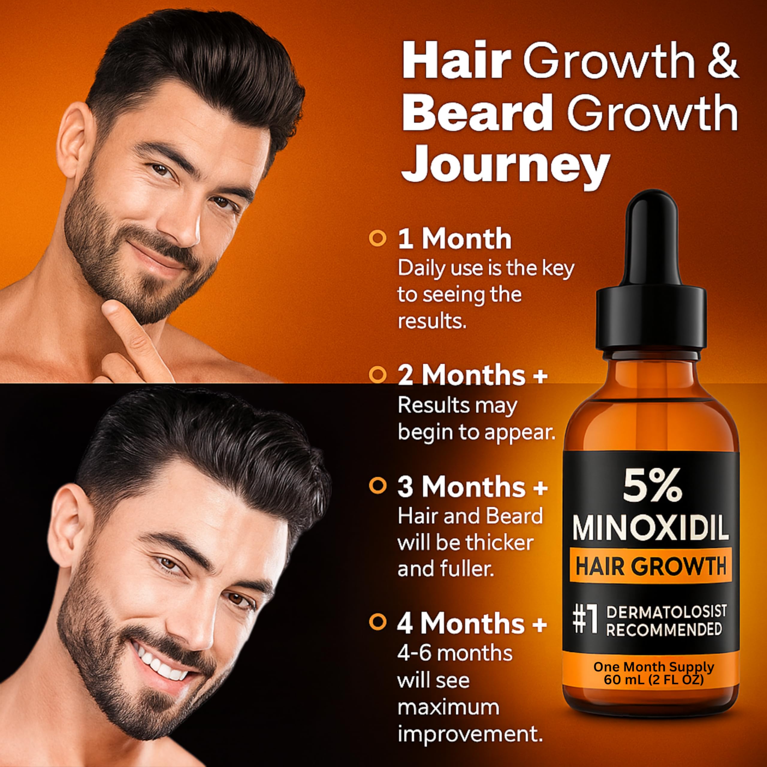 Nincrane Minoxidil 2oz supply box ready for two months of use.