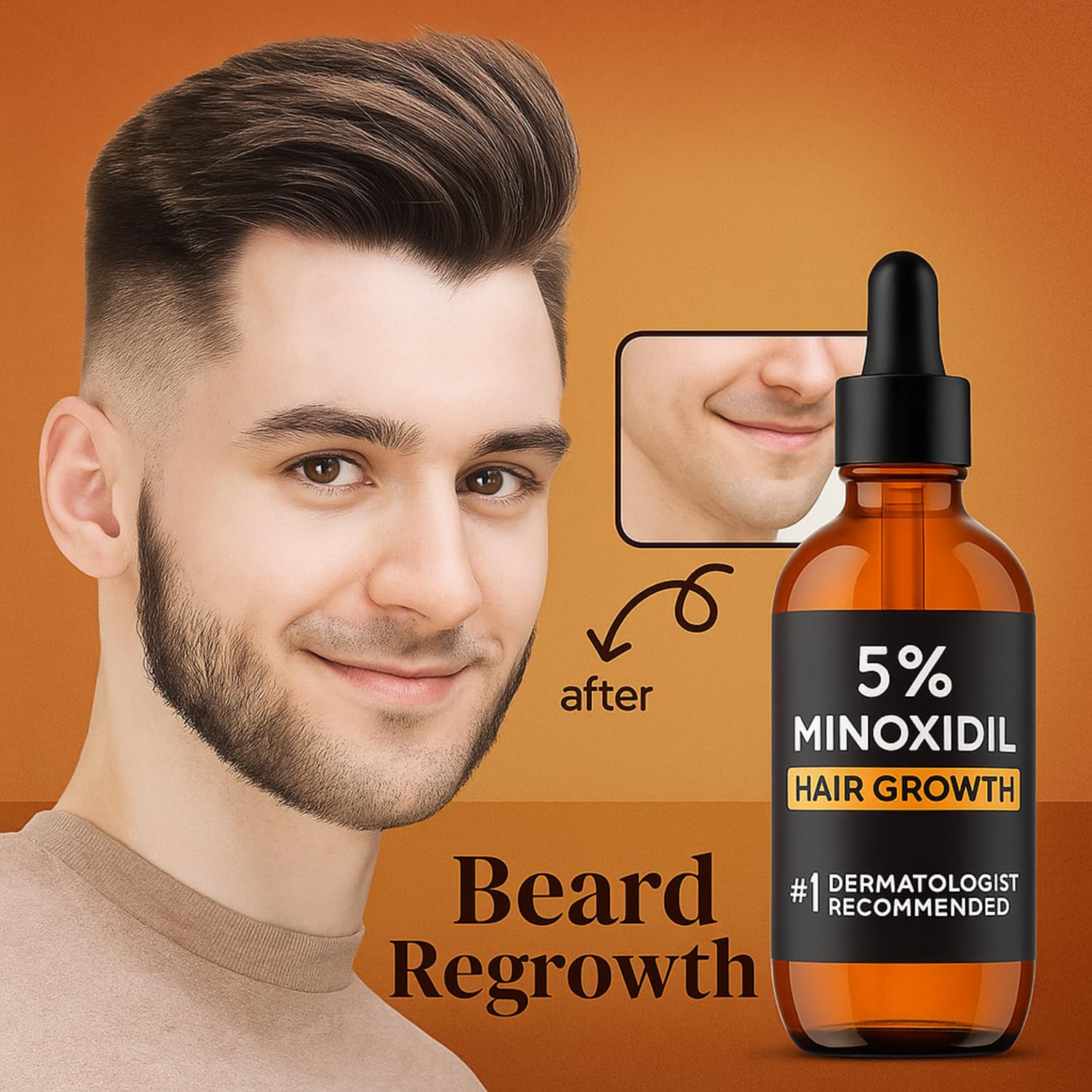 Matte-finish Nincrane Minoxidil bottle on a clean shelf.