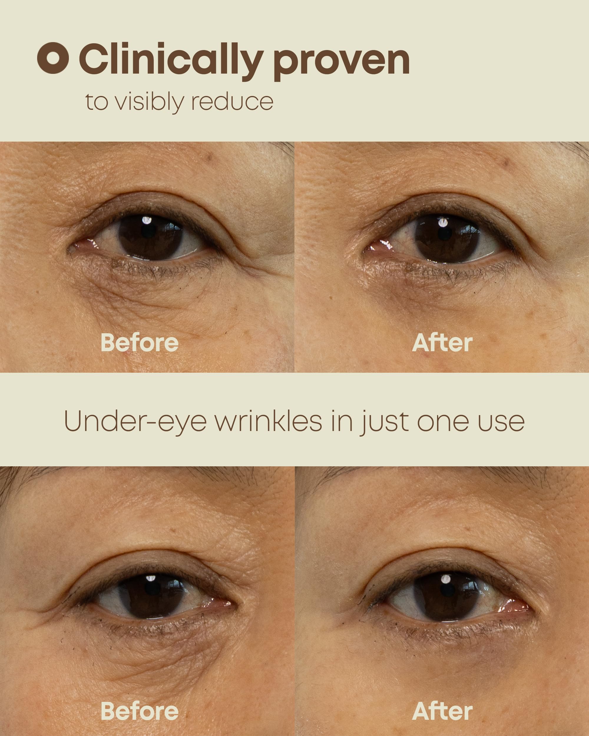 NINELESS Ever-Youth eye cream second skin film-forming layer around the under-eye area for subtle lift