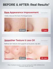 NING DERMOLOGIE tembusu extract botanical closeup for calming complexion