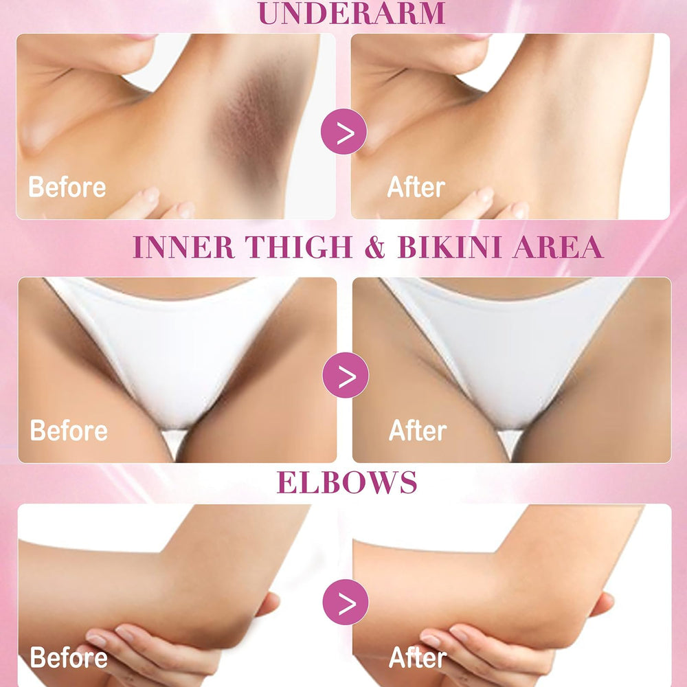 Nivexis Cream texture provides light hydration without clogging pores