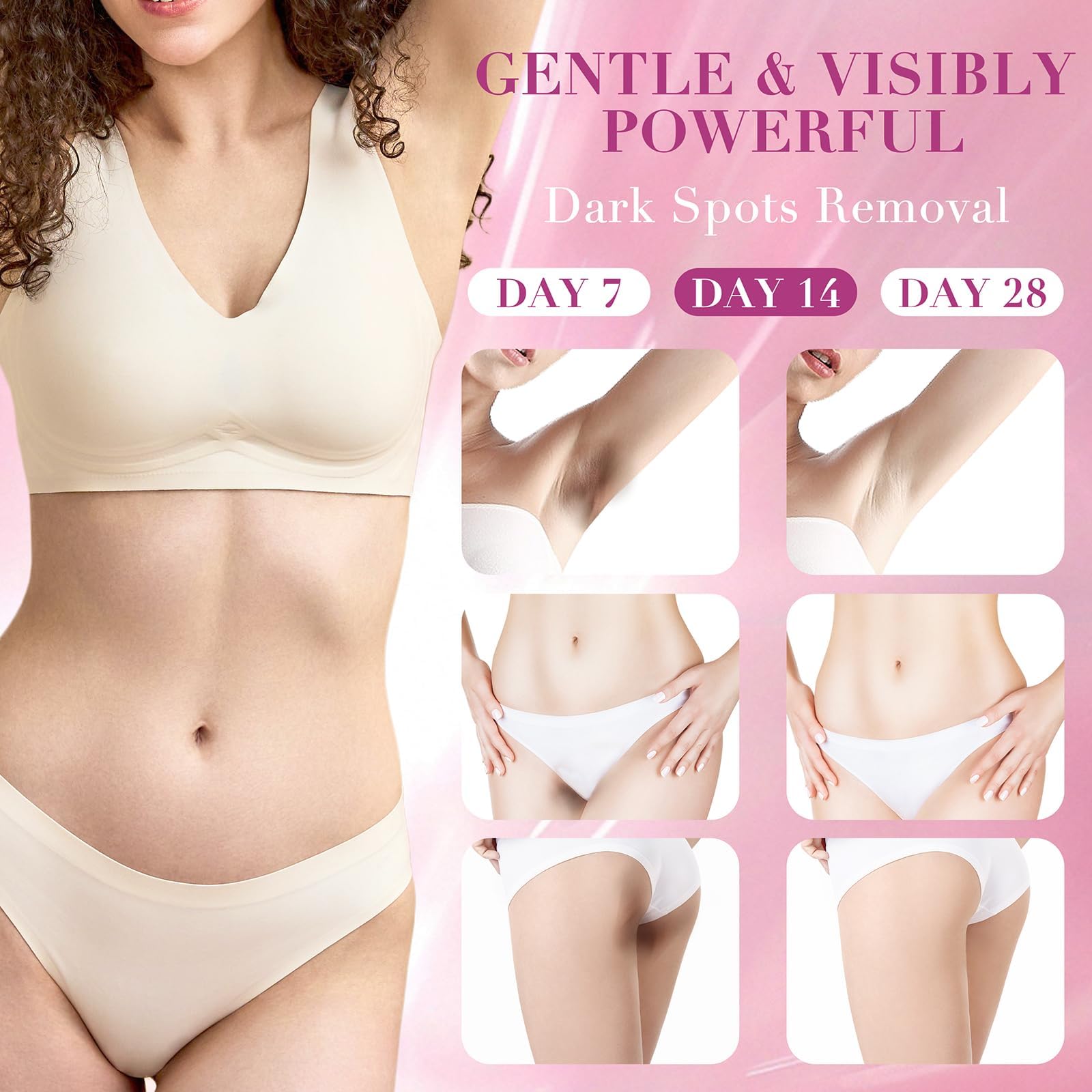 Nivexis Key ingredients Niacinamide and Arbutin support gentle discoloration reduction