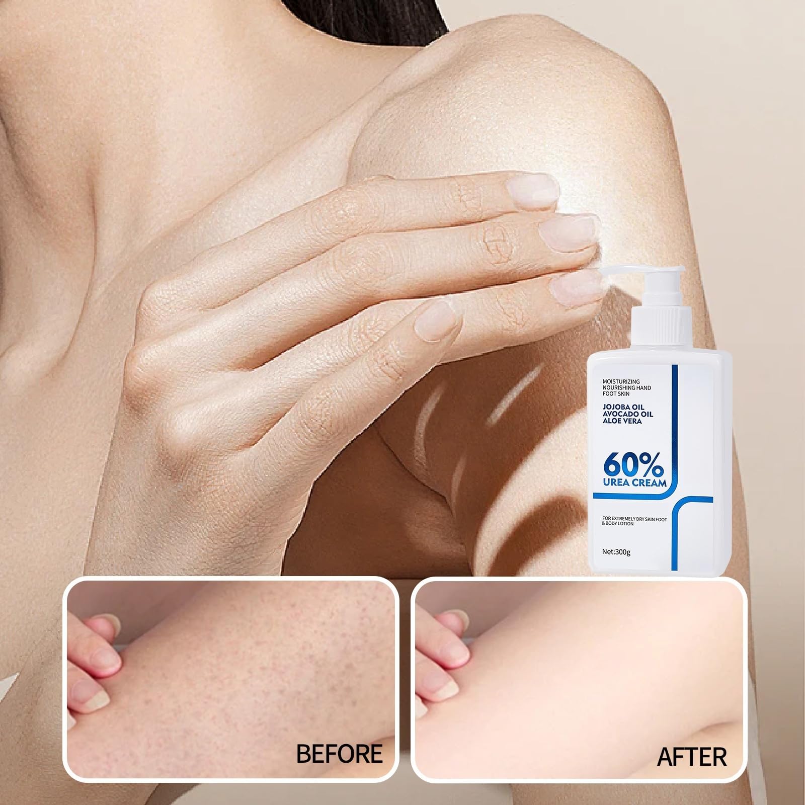 NIZENTA Urea Cream applied on arm demonstrates fast absorption and a light finish.