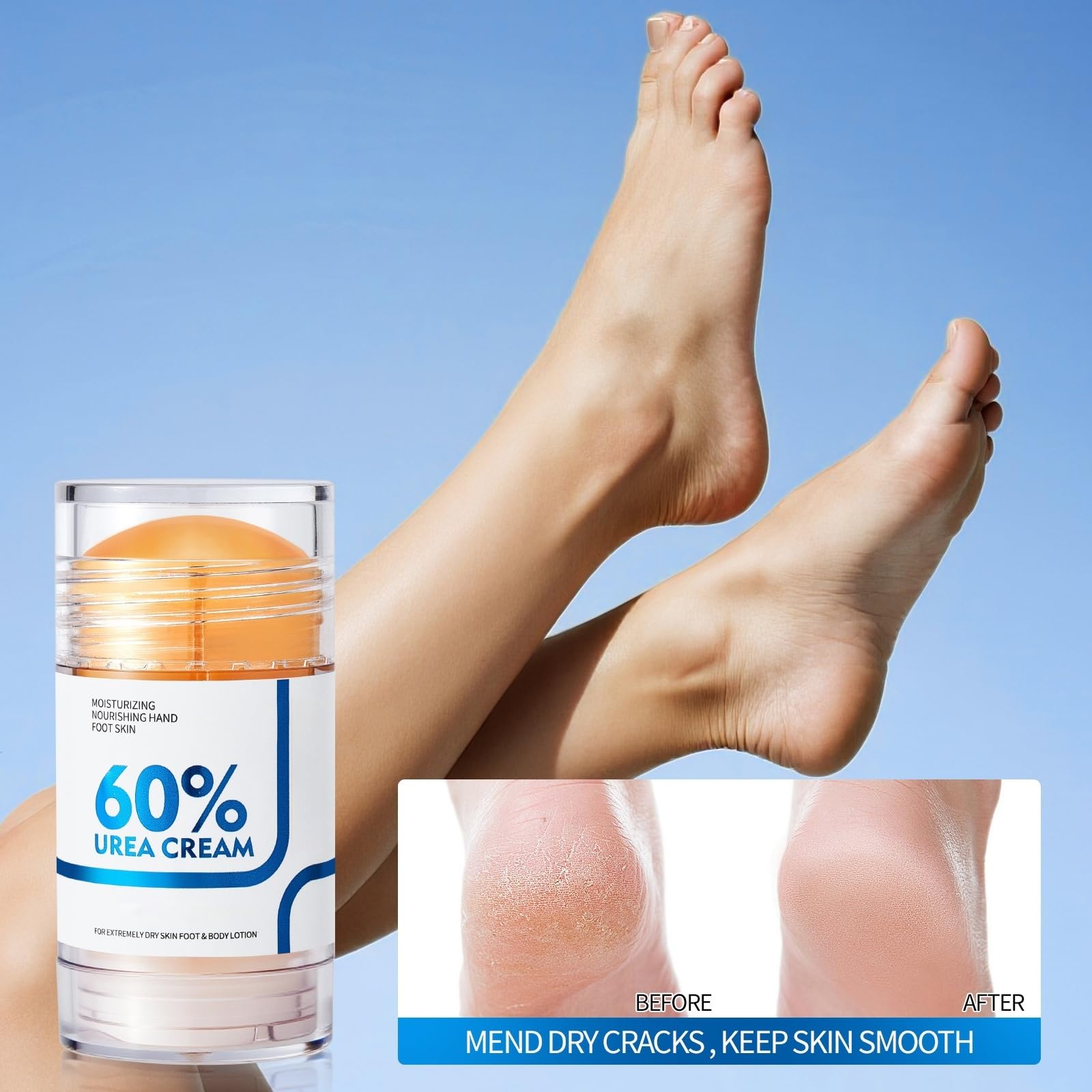 NIZENTA Urea Stick suitable for elbows and knees and feet.